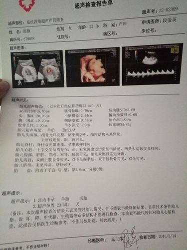 四维一次性通过!男宝一枚!