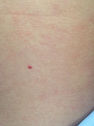 身上有几个小红点是怎么回事啊,不痛也不痒