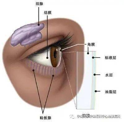 灼烧和异物感等,这些症状会刺激我们眼睛的泪腺反射性地分泌出大量的