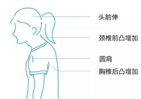 关注儿童脊柱健康,做"挺拔少年"公益活动