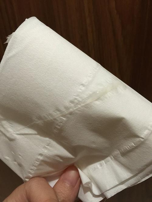 治疗支原体一段时间了,今天的白带是这样的,正常吗?是因为在排卵期吗?