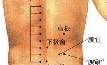 【学一穴】痞根穴:治疗腰肌劳损,肾下垂