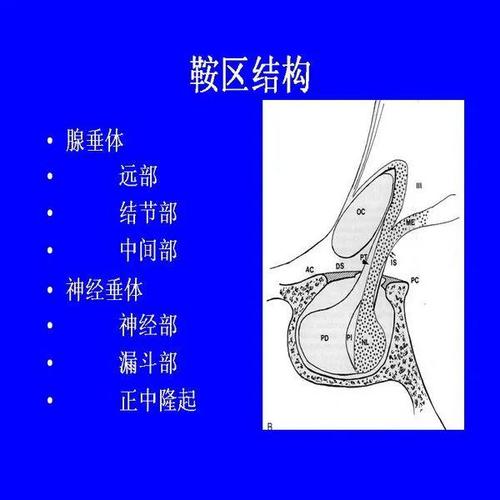 鞍区病变影像诊断上