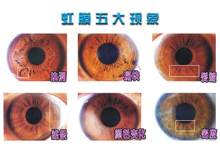 解读虹膜的要领上