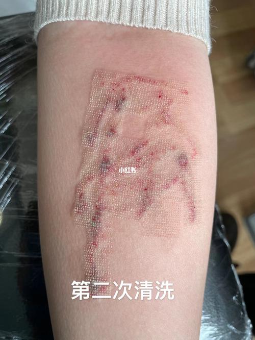 清洗纹身第一次恢复后效果返图及二次清洗_纹身_掉色