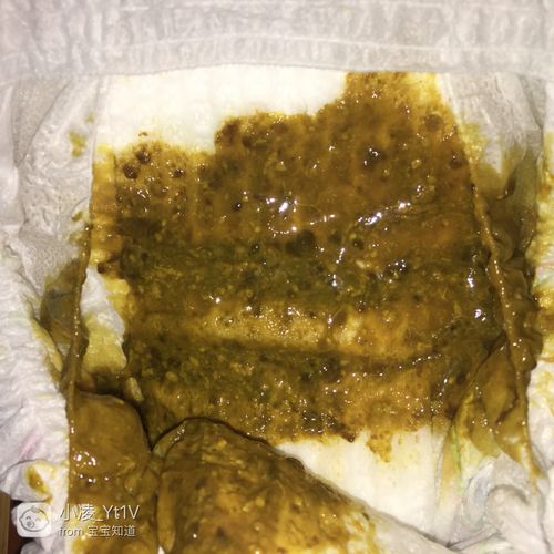 宝宝拉这种粑粑 是不消化吗?