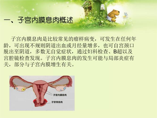 子宫内膜息肉科普课件pptx10页