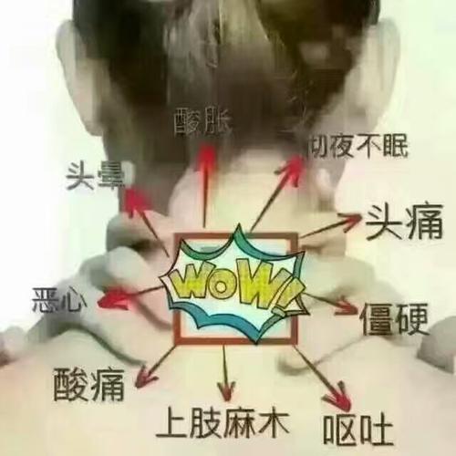 颈肩背痛,活动受限,上肢痛麻,颈性头痛,头晕头昏,咽喉肿痛,心慌失眠