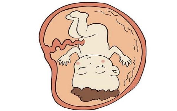 孕妇胎盘低置须知,怎么长上去全靠这3大睡觉姿势!