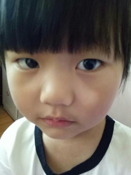 女儿脸上有一片白色,谁能帮我看下