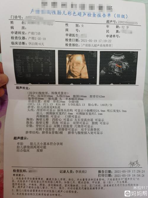 24周做的四维彩超