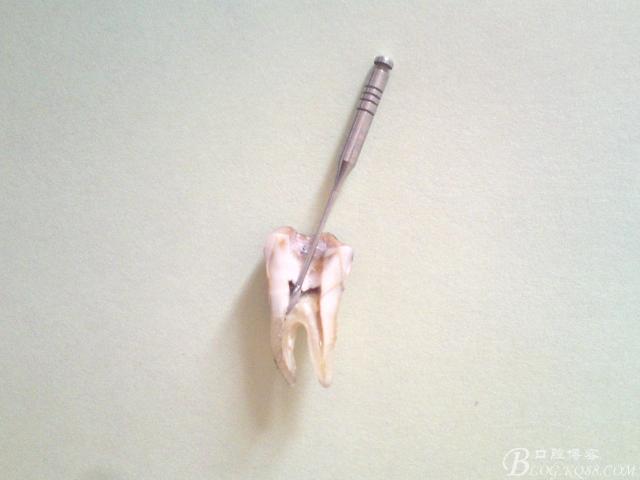 实用根管冲洗技术与临床心得讲义戴宇勇