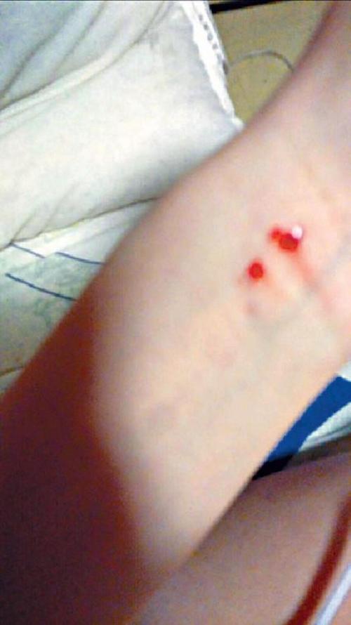 女星泪诉被经纪人施暴2年 工作结束就开房