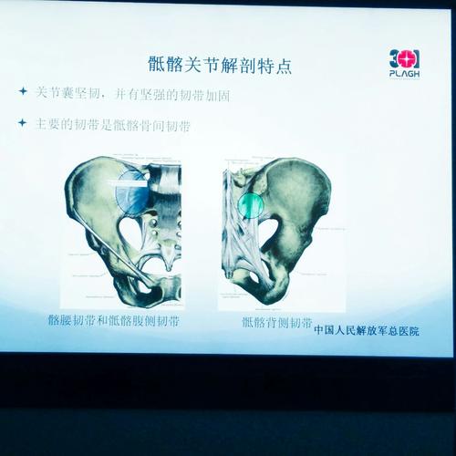 骶髂关节常见疾病mri诊断