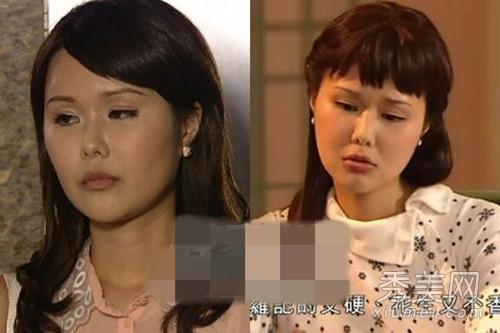 刘思希整容失败变面瘫