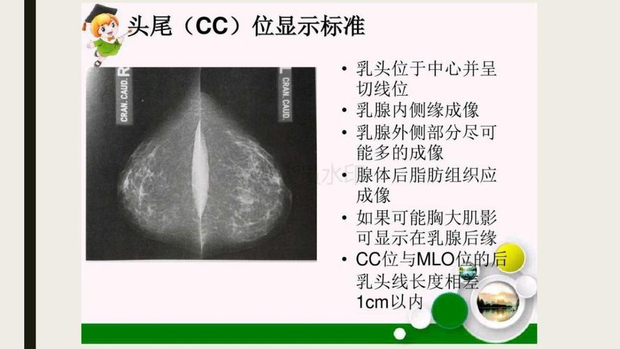 带你了解乳腺钼靶基本认知