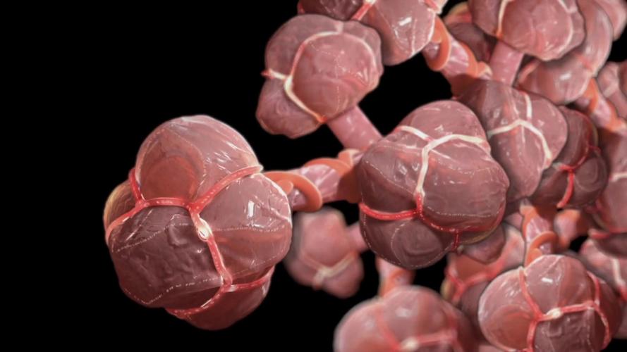 肺病呼吸疾病肺泡机理医学3d动画视频素材