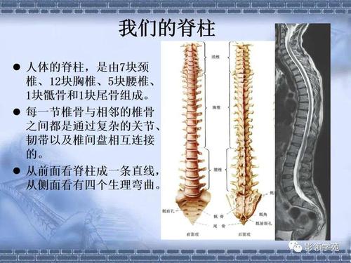 颈椎,腰椎常见ct影像表现