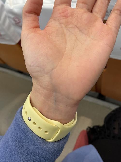 大家的手掌血管会很明显吗