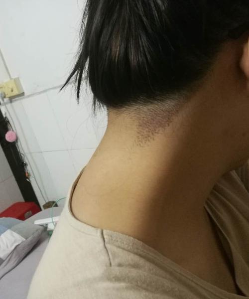 结果她们撩开我后面的头发惊呆了,觉得后发际线太夸张像男生,显得脖子