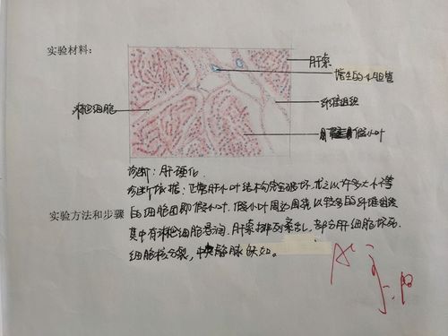 病理学红蓝铅笔绘图