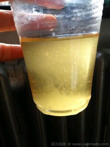 孕妇尿里放盐的变化 晨尿加盐看男女的图片