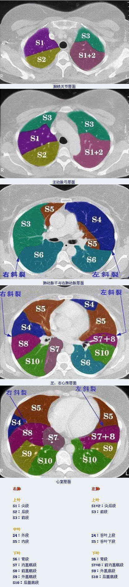 ct肺分叶分段