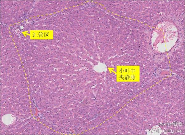 汇管区,这两个结构之间是大量排列成 条状,放射状 的肝细胞(红色的是