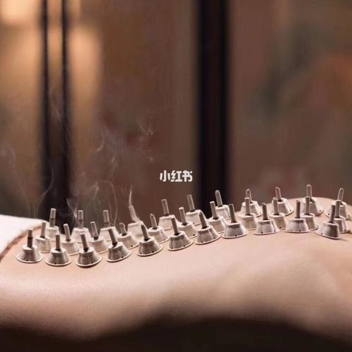 艾灸背部好处多_艾灸_医疗健康_医疗健康其他
