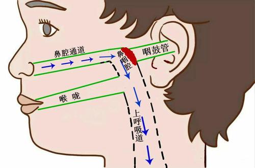 腺样体是啥?为什么肥大就惹祸?