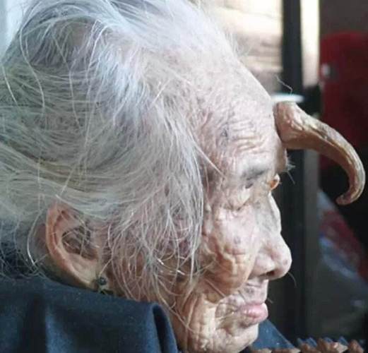 九旬老太额头长角,误信大师真龙转世,知道原因让人震惊!