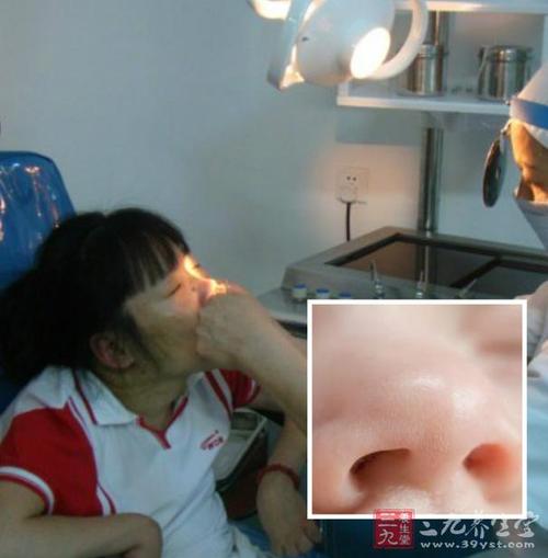 鼻息肉的诊断及治疗方法都有哪些