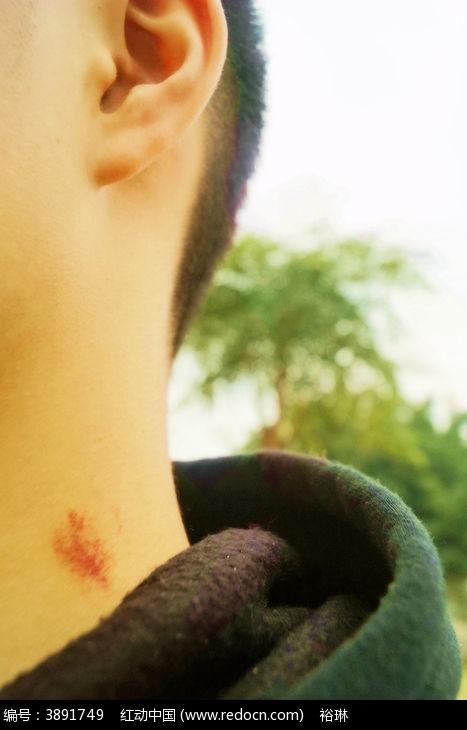 脖子上的草莓印