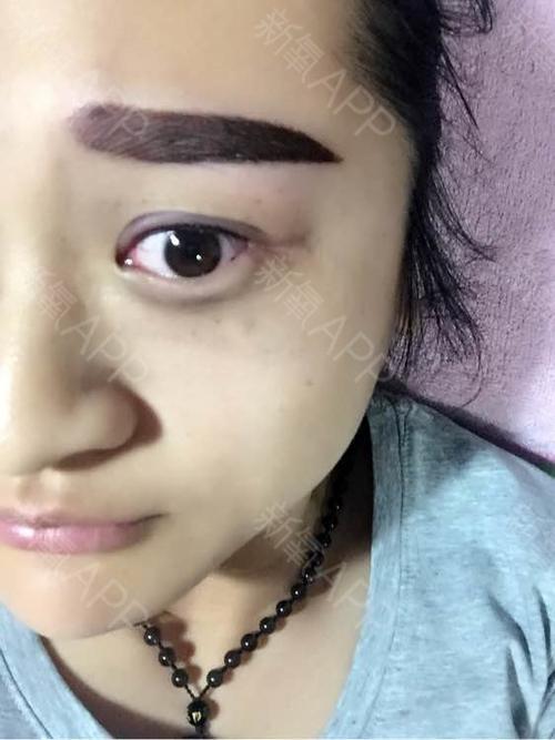 结痂脱落期半永久纹眉第 天           ·           第2篇日记