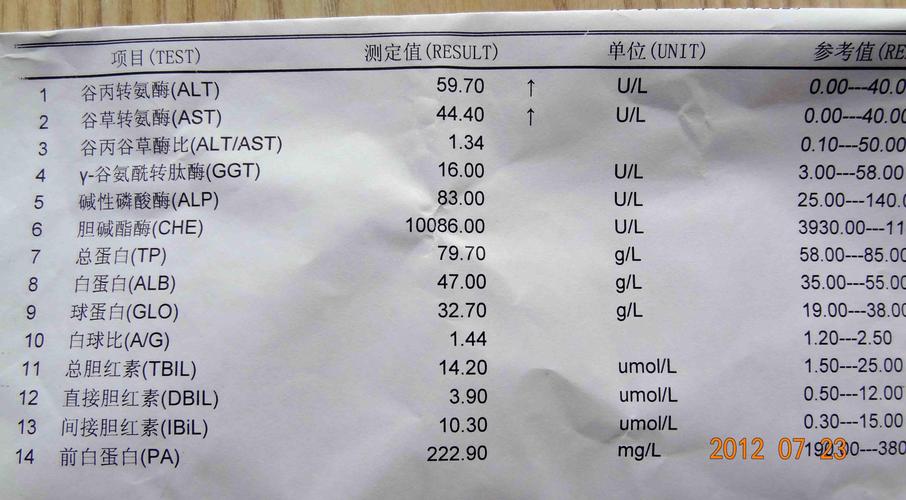教你轻松看懂,"肝功能"化验单的重要指标,简单