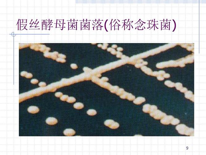 假丝酵母菌菌落(俗称念珠菌)