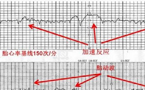 胎儿的胎心率一般是在一百二十