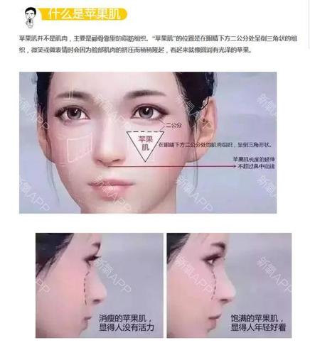 说说与苹果肌有关的那些事儿(一)