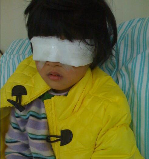 3岁的孩子突然失明,只因妈妈做了这件事,太可怕