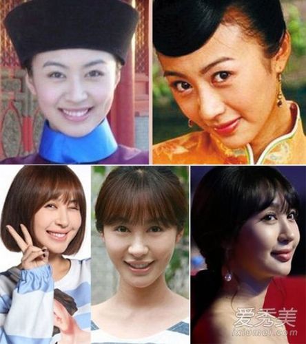 10大整容嫌疑人 女有baby李菲儿男有陈学冬