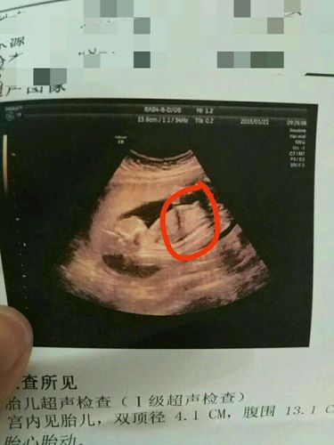 无聊来聊聊nt看男女