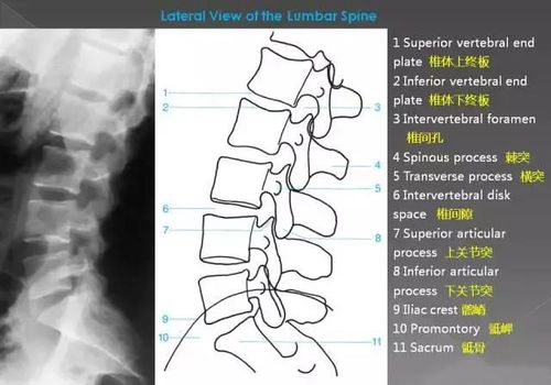 详细的腰椎x线解剖 解读|关节|弓根|曲度|椎体_网易