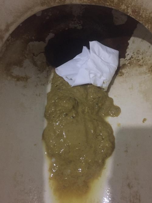 请问这是拉肚子吗?每天一到2次,有时候还要希一些!