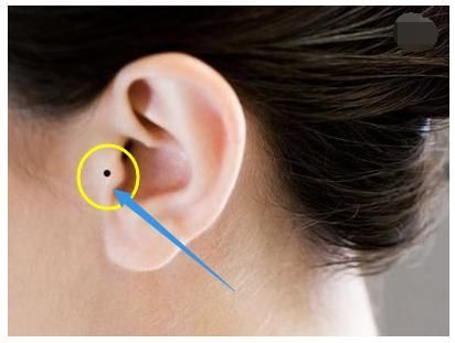 耳朵的痣相图片