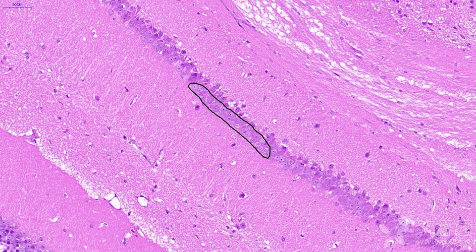 海马he染色求助