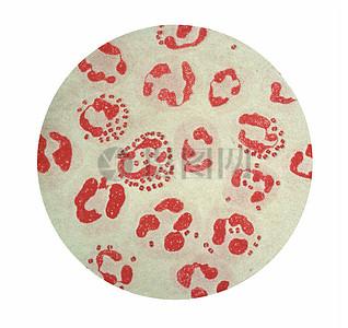 用革兰氏染色技术观察淋球菌的显微照片.图片