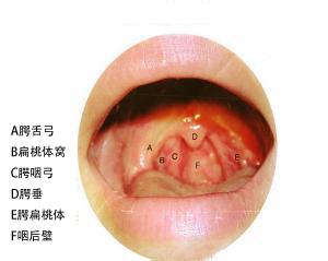 饮酒对 慢性咽炎危害