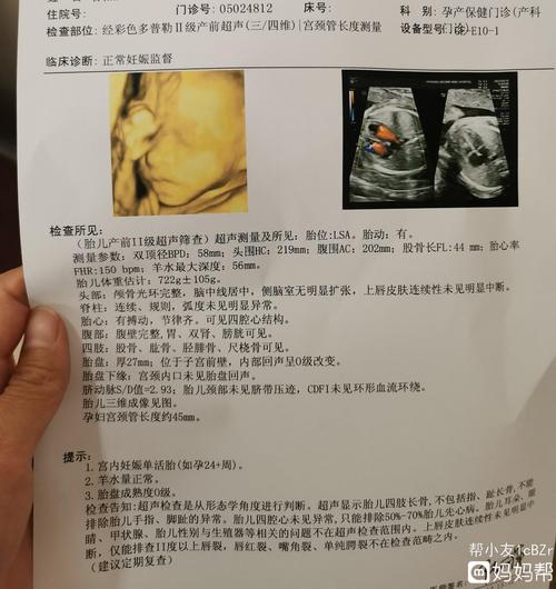 四维彩超看起来像个妹妹的样子