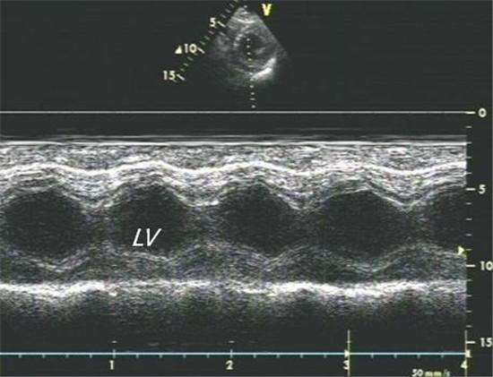 (m型超声心动图左室短轴切面显示心肌收缩运动较正常稍有增强)