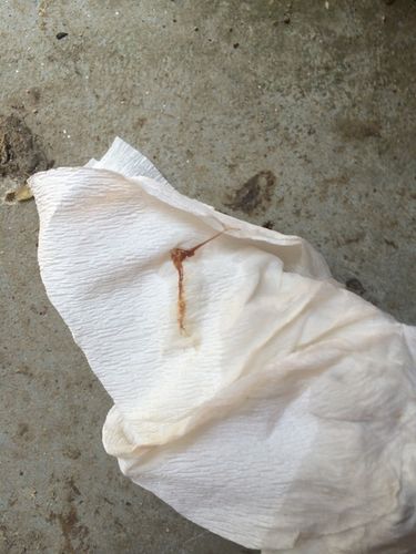 怀孕4周绒毛毛腺腺激素3870.00孕酮7.5.